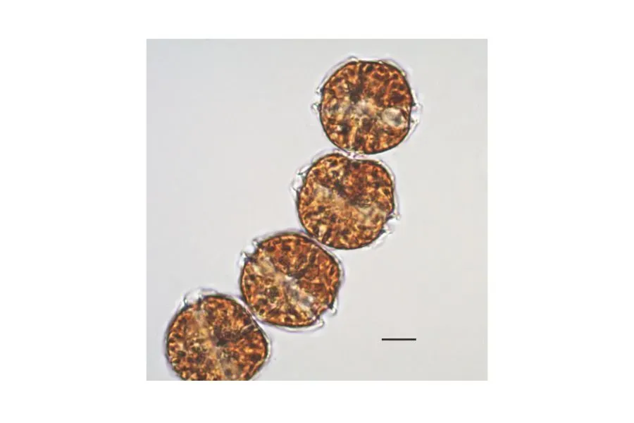 Alexandrium catenella. Ejemplo de microalga t&oacute;xica.