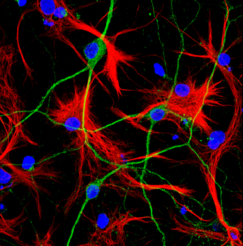 astrocito neurona .png