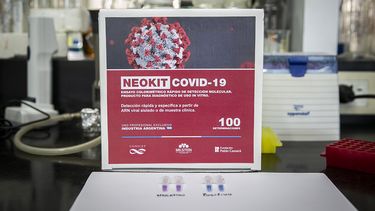 Con resultados en menos de dos horas: Argentina elabora examen propio para detectar COVID-19