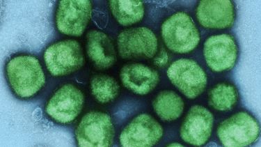 OMS recuerda que la vacuna contra viruela del mono tarda semanas en inmunizar