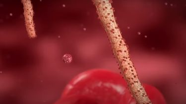 La OMS confirma una tercera muerte por el virus de Marburgo en Ghana