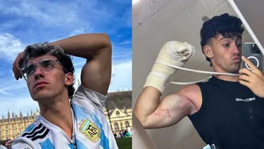 Así quedó influencer argentino Gero Arias tras caer de acantilado y perder 2 dedos: No la contaba