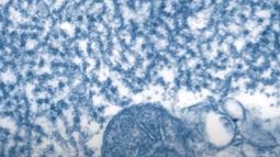 Henipavirus: Detectan en China 35 casos en humanos de una nueva patología de origen animal