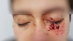 No queremos lacras como tú viviendo: Nuevo ataque transfóbico en Osorno