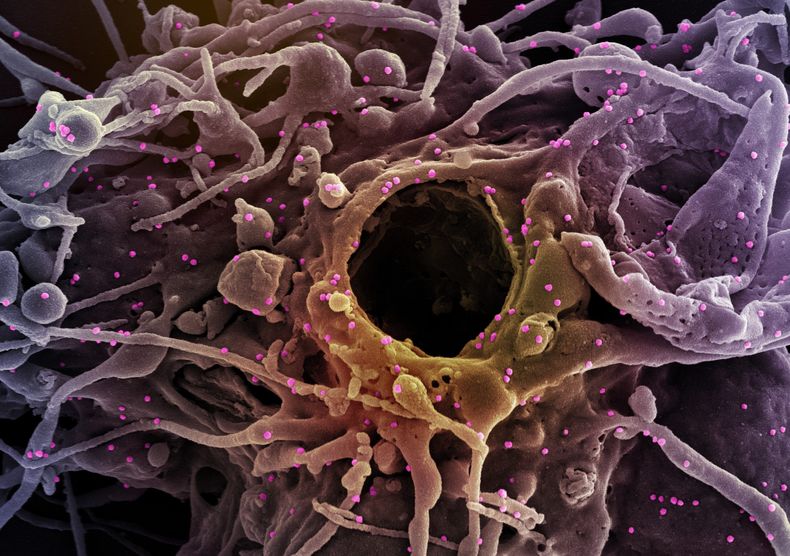 COVID 19 2 scaled.jpg