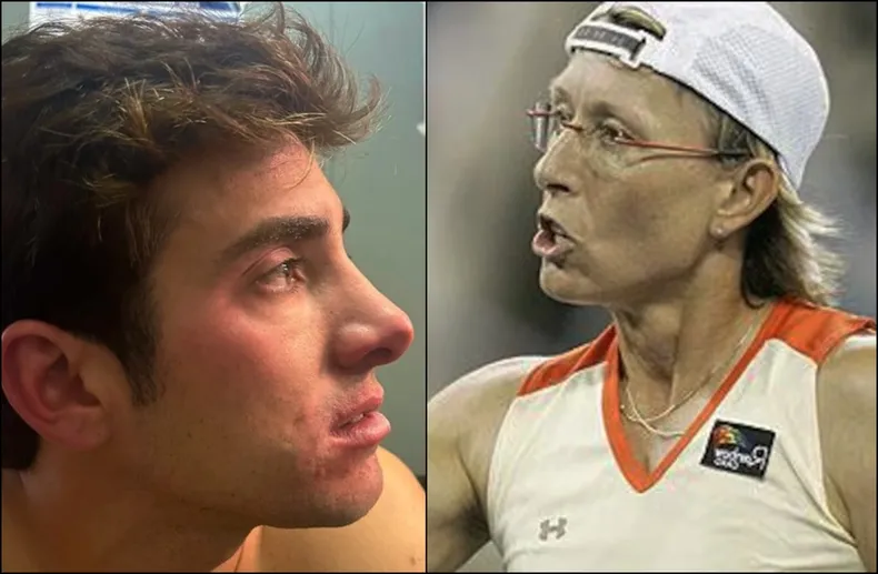 11020 garin navratilova.webp