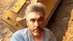 “Lo hace como una forma de amedrentar”: Ambientalistas del Maule repudian violento ataque a activista