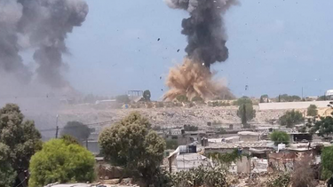 Duro relato de médico en Gaza: Hubo una fuerte explosión y techo cayó sobre el quirófano