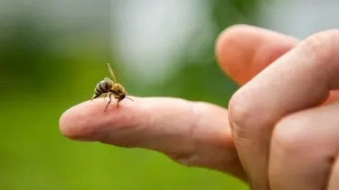 Picadura de abeja en verano: cómo identificar los síntomas a tiempo y evitar el desarrollo de anafilaxia