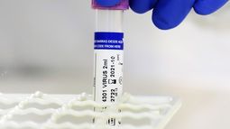 Moderna acuerda suministrar 80 millones de dosis de su vacuna a la UE