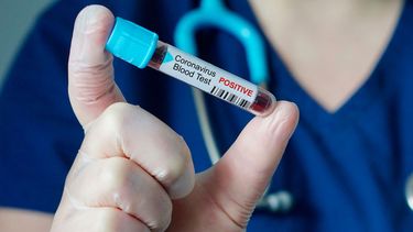 Brasil alcanza cifra récord de muertos por coronavirus en las últimas 24 horas