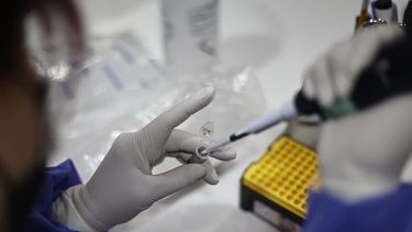 Viruela del mono: OMS levanta la emergencia mundial, pero llama a seguir alertas