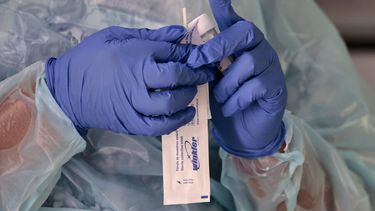 Confirman brote de tuberculosis en curso completo en colegio de Viña del Mar