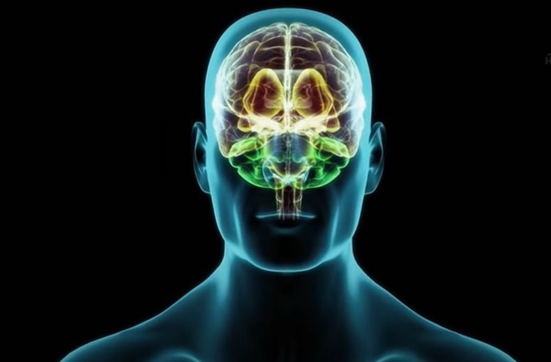 Image Cerebro.jpg
