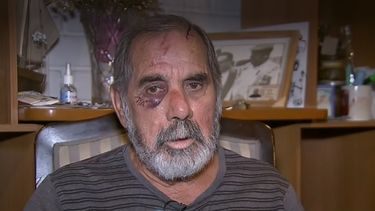 Habla abuelo agredido violentamente por Carabineros: “No había necesidad de seguir golpeándome”