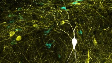 Actualizan base de datos con más de 120 neuronas del hipocampo