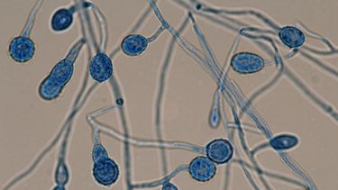 Por ahora, el equipo se concentra particularmente en la fase de descripción y caracterización de los hongos. Por ahora, el equipo se concentra particularmente en la fase de descripción y caracterización de los hongos.