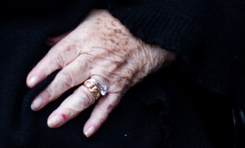 alzheimer e1688487446244.jpg