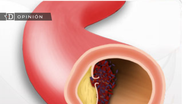 El Desconcierto | Enferemdad de Kawasaki e1706200557774.png