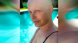 Revelan estado de salud de Claudia Conserva en medio de su ardua lucha contra el cáncer