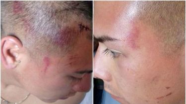 Hermano de Eduardo Vargas denuncia que Carabineros lo golpeó y destruyó su celular por grabar: Estoy todo adolorido
