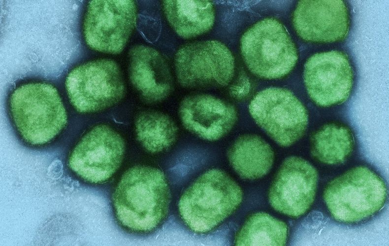 Viruela del mono Flickr Niaid.jpg