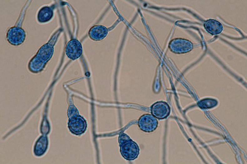 &nbsp;Por ahora, el equipo se concentra particularmente en la fase de descripción y caracterización de los hongos.