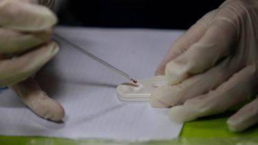 Experto: Nuestro país tiene las mejores condiciones para terminar con el SIDA