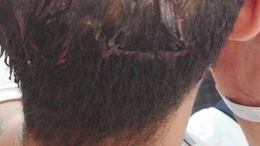 Denuncian un nuevo ataque homofóbico en Antofagasta
