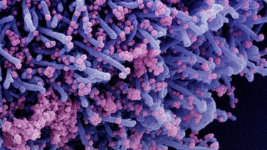 Japón registra récord de casos de Covid diarios con más de 107.000