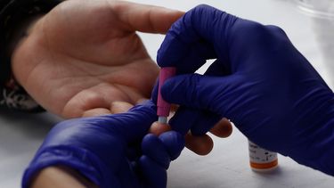 20 mil personas en Chile expuestas a desarrollar Sida: Piden crear Plan Nacional para identificarlos