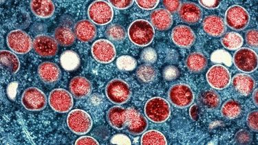 Siete países africanos registran 1.400 casos de viruela del mono en 2022