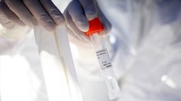 COVID-19: Rusia inicia la producción de su segunda vacuna anticoronavirus, EpiVacCorona