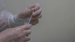 Viruela Mpox: Gobierno decreta Alerta Sanitaria Preventiva en todo Chile