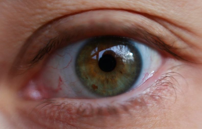 Ojo.jpg