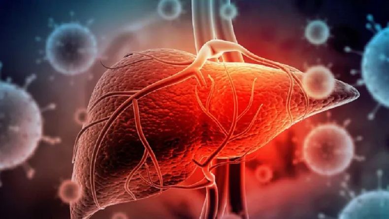 hepatitis aguda infantil.jpg