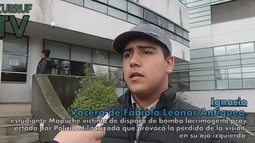 VIDEO| Vocero de joven que perdió ojo izquierdo tras ataque de Carabineros anuncia acciones legales
