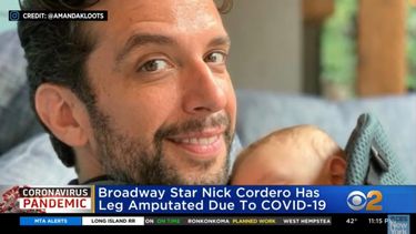 Conmoción en Estados Unidos por joven actor que perdió su pierna a causa del coronavirus