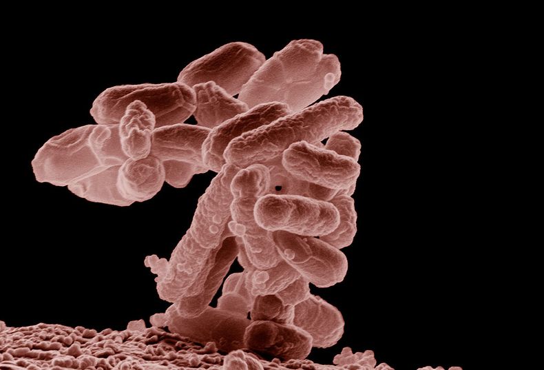 Niño murió en Curanilahue por contraer la bacteria Escherichia coli - Captura de video&nbsp;