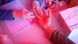 Diagnóstico temprano de VIH podría reducir muertes relacionadas con sida en América Latina y el Caribe