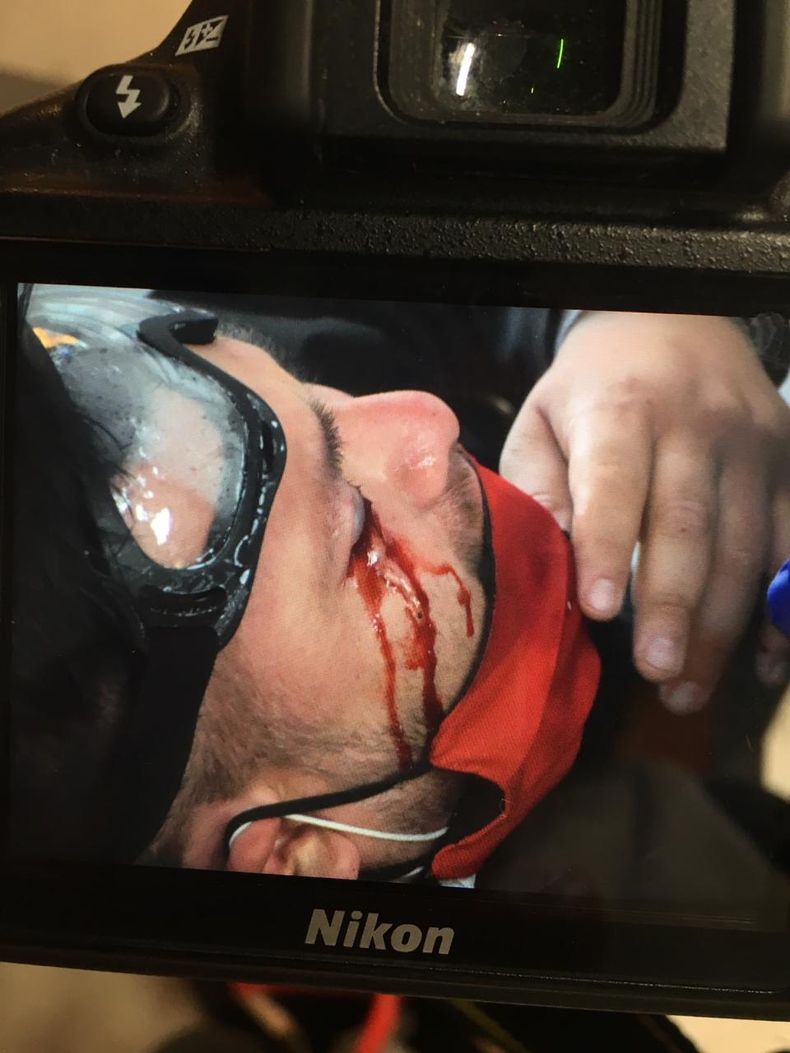 trauma ocular.jpg