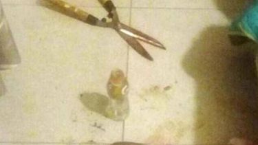 Aplicó la autodefensa: Mujer corta pene a hombre con tijera podadora tras ser presuntamente agredida