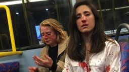 Hombres agreden de manera brutal a pareja de lesbianas en Londres tras ordenarles que se besaran