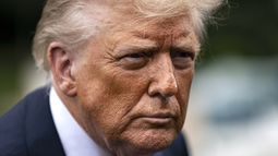 Insuficiencia venosa crónica: Así es la enfermedad que padece Donald Trump a sus casi 80 años