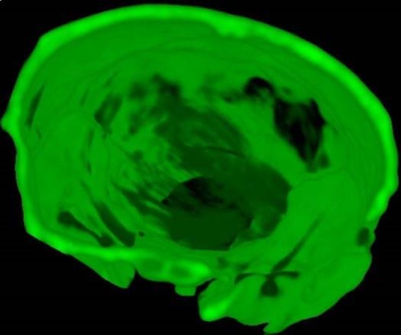 Nota de oro y alzheimer 04 L.jpg