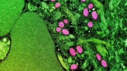 OMS: La viruela del mono se puede frenar si se toman en serio sus riesgos