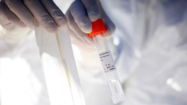 COVID-19: Rusia inicia la producción de su segunda vacuna anticoronavirus, EpiVacCorona