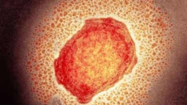 Viruela del mono: Argentina confirma oficialmente su primer caso infectado