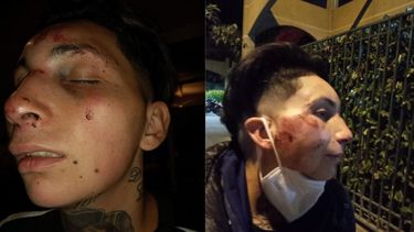 El Desconcierto | Mujer atacada en Lampa.jpeg