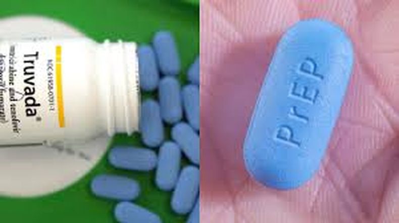 prep.jpg